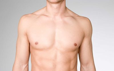 Gynäkomastie